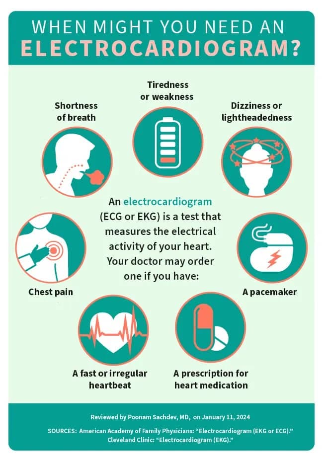 ECG (Electrocardiogram)