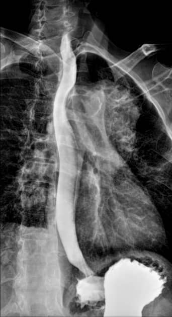 Fluoroscopy